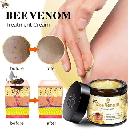 Bee Venom Skin Treatment Cream,Repair Maximum Strength for All Skin Types (1PCS)